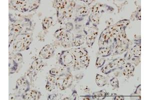 Image no. 1 for anti-Forkhead Box R2 (FOXR2) (AA 1-312) antibody (ABIN599326) (FOXR2 anticorps  (AA 1-312))