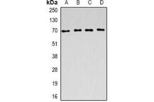 Western blot analysis of ACADVL expression in SW620 (A), Raji (B), mouse kidney (C), rat liver (D) whole cell lysates. (ACADVL anticorps)
