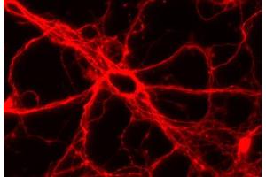Immunocytochemistry (ICC) image for anti-tau Protein (AA 3-214) antibody (ABIN1742569)