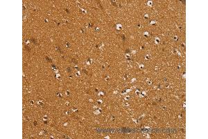 Immunohistochemistry of Human brain  using SLC16A3 Polyclonal Antibody at dilution of 1:30 (SLC16A3 anticorps)