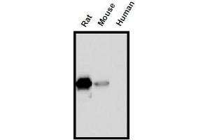 Western Blotting (WB) image for anti-Interleukin 18 (IL18) (AA 37-194) antibody (ABIN1449292) (IL-18 anticorps  (AA 37-194))