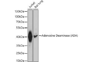 Western blot analysis of extracts of various cell lines, using Adenosine Deaminase (ADA) antibody (ABIN3021281, ABIN3021282, ABIN3021283 and ABIN6214343) at 1:1000 dilution.