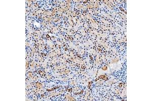 IHC analysis of SNRNP200 using anti-SNRNP200 antibody (ABIN7602032).