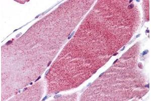 Human Skeletal Muscle: Formalin-Fixed, Paraffin-Embedded (FFPE)