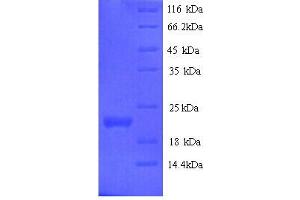 SDS-PAGE (SDS) image for Interferon epsilon (IFNE) (AA 22-192) protein (His tag) (ABIN5714414)