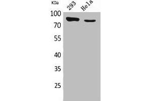 Western Blot analysis of 293, HeLa cells using DRA Polyclonal Antibody. (SLC26A3 anticorps  (C-Term))