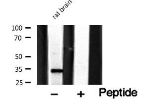 Western blot analysis on rat brain lysate using MAGE-1 Antibody