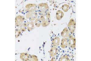 Immunohistochemistry of paraffin-embedded human stomach using YAP1 antibody (ABIN5974703) at dilution of 1/100 (40x lens). (YAP1 anticorps)