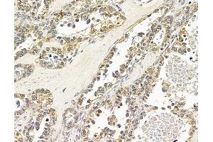anti-Nitric Oxide Synthase 1 (Neuronal) Adaptor Protein (NOS1AP) antibody