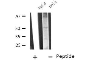 Western blot analysis of extracts from HeLa cells, using SLC38A2 antibody. (SLC38A2 anticorps  (Internal Region))