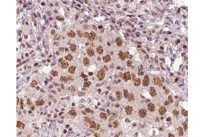 ABIN6266816 at 1/100 staining human liver tissue sections by IHC-P. (XRN2 anticorps)