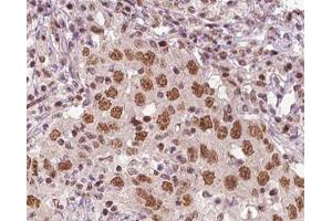 ABIN6266816 at 1/100 staining human liver tissue sections by IHC-P.