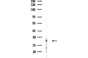 Western blot analysis of lysates from MDA-MB-231 cells(heat-shock,45 min treatment), using RC Antibody at 1/1000 dilution.