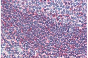 Human Tonsil (formalin-fixed, paraffin-embedded) stained with GSC antibody ABIN462175 followed by biotinylated goat anti-rabbit IgG secondary antibody ABIN481713, alkaline phosphatase-streptavidin and chromogen.