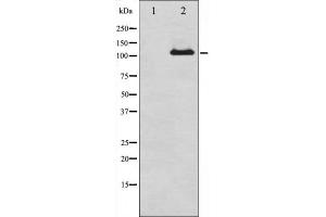Western blot analysis of Progesterone Receptor expression in whole cell lysates,The lane on the left is treated with the antigen-specific peptide.