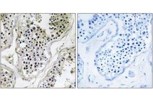 Immunohistochemistry analysis of paraffin-embedded human testis tissue, using ATXN7L1 Antibody. (ATXN7L1 anticorps  (AA 441-490))