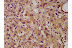 IHC image of ABIN7174623 diluted at 1:300 and staining in paraffin-embedded human liver tissue performed on a Leica BondTM system.