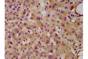 IHC image of ABIN7174623 diluted at 1:300 and staining in paraffin-embedded human liver tissue performed on a Leica BondTM system. (UGT1A1 anticorps  (AA 395-482))