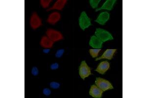 ABIN7096890 and ABIN7100956 staining Hela cells(30 min of UV treatment) by IF/ICC. (QPCTL anticorps)