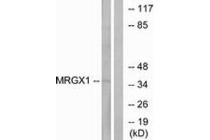 Western blot analysis of extracts from MCF-7 cells, using MRGX1 Antibody. (MRGPRX1 anticorps  (AA 271-320))