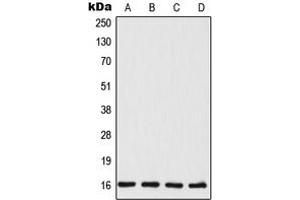 Western blot analysis of TSC22 expression in MCF7 (A), HeLa (B), mouse liver (C), rat liver (D) whole cell lysates. (TSC22D1 anticorps  (C-Term))