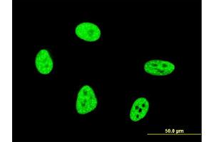 Immunofluorescence of monoclonal antibody to OXSR1 on HeLa cell.