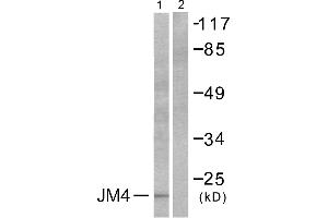 Western blot analysis of extracts from LOVO cells, using JM4 antibody (#C0238). (PRAF2 anticorps)