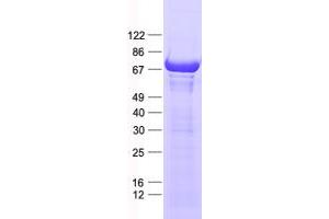 Validation with Western Blot
