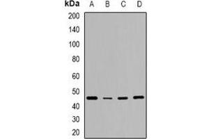 Western blot analysis of CD240d expression in HeLa (A), NIH3T3 (B), mouse brain (C), rat brain (D) whole cell lysates. (RHD anticorps)