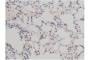 ABIN6267411 at 1/200 staining Rat lung tissue sections by IHC-P.