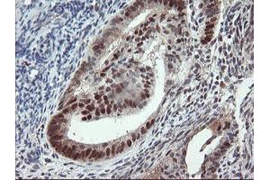 Image no. 2 for anti-Ubiquitin-Conjugating Enzyme E2E 3 (UBE2E3) antibody (ABIN1501617)