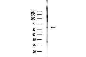 anti-Receptor-Interacting Serine-threonine Kinase 2 (RIPK2) (pSer176) antibody