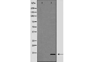 Western blot analysis of Trefoil factor 2（TFF2） expression in HeLa cells,The lane on the left is treated with the antigen-specific peptide. (Trefoil Factor 2 anticorps  (Internal Region))