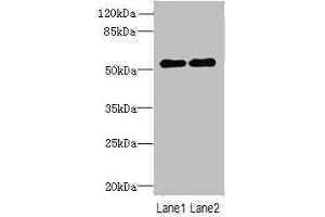 Western blot All lanes: TRMT6 antibody at 4 μg/mL Lane 1: U251 whole cell lysate Lane 2: HepG2 whole cell lysate Secondary Goat polyclonal to rabbit IgG at 1/10000 dilution Predicted band size: 56, 45, 41, 37 kDa Observed band size: 56 kDa (TRMT6 anticorps  (Catalytic Subunit))