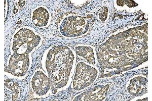 IHC analysis of Ezrin/EZR using anti-Ezrin/EZR antibody (ABIN7603214). (Ezrin anticorps  (N-Term))