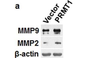 PRMT1 promoted migration and invasion in breast cancer cells.