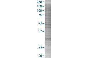 TGFB1 transfected lysate. (TGFB1 293T Cell Transient Overexpression Lysate(Denatured))