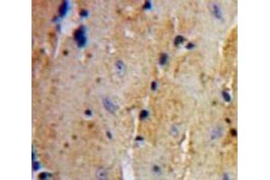 Used in DAB staining on fromalin fixed paraffin-embedded Heart tissue