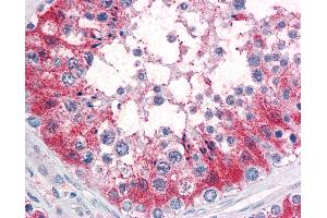 Anti-SRPX2 antibody IHC of human testis.