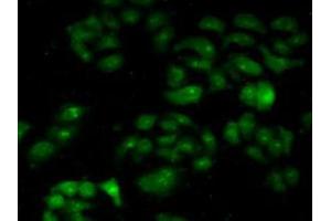 IHC-P analysis of Human HeLa cells, with FITC staining. (CAPNL1 anticorps  (AA 387-694))