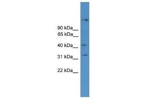 SYT11 antibody used at 0. (SYT11 anticorps  (N-Term))