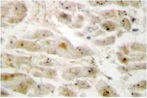 Immunohistochemistry: LIMK2 antibody staining of Paraffin-Embedded Human brain tissue. (LIMK2 anticorps)