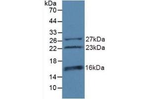 Detection of Recombinant CHD3, Human using Polyclonal Antibody to Chromodomain Helicase DNA Binding Protein 3 (CHD3)