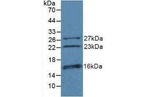 Detection of Recombinant CHD3, Human using Polyclonal Antibody to Chromodomain Helicase DNA Binding Protein 3 (CHD3) (CHD3 anticorps  (AA 1551-1742))