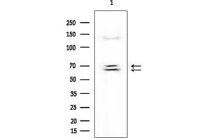 Western blot analysis of lysates from Mouse testis, using IGF2BP3 Mouse Monoclonal Antibody at 1/1000 dilution.