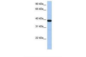 Image no. 1 for anti-Zinc Finger Protein 781 (ZNF781) (N-Term) antibody (ABIN6739309) (ZNF781 anticorps  (N-Term))