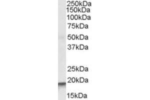 Western Blotting (WB) image for anti-Actin Related Protein 2/3 Complex, Subunit 4, 20kDa (ARPC4) (AA 31-41) antibody (ABIN342994) (ARPC4 anticorps  (AA 31-41))