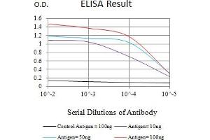 Black line: Control Antigen (100 ng),Purple line: Antigen (10 ng), Blue line: Antigen (50 ng), Red line:Antigen (100 ng)