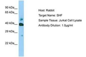 Image no. 1 for anti-Src Homology 2 Domain Containing F (SHF) (AA 22-71) antibody (ABIN6749970) (SHF anticorps  (AA 22-71))