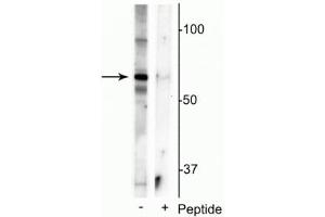 Western blot of mouse whole brain lysate showing specific immunolabeling of the ~55 kDa truncated MeCP2 protein phosphorylated at Ser421 in the first lane (-). (MECP2 anticorps  (pSer421))